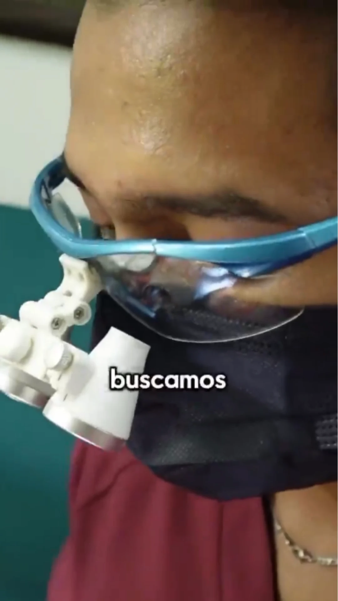 Proceso de Cambio de Calzas
